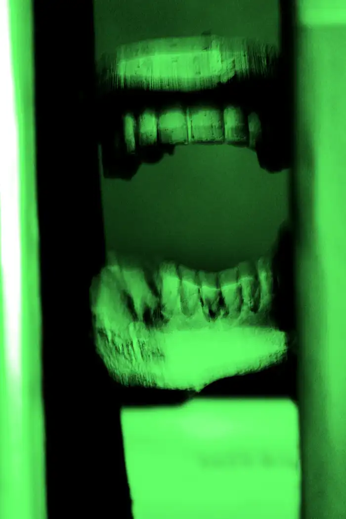 Coma n5